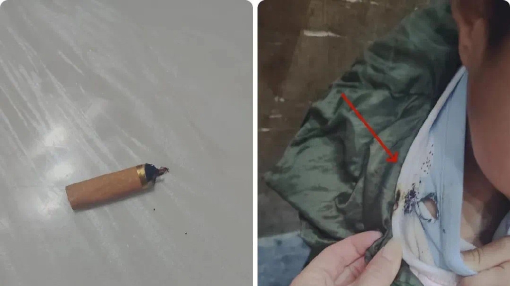 天降煙頭燒穿6歲男童棉衣。