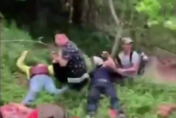 有大人的腿部明顯外翻骨折。(網圖)