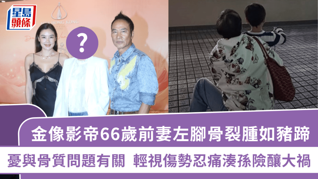 金像影帝66岁前妻左脚骨裂肿如猪蹄  忧与骨质问题有关   轻视伤势忍痛凑孙险酿大祸