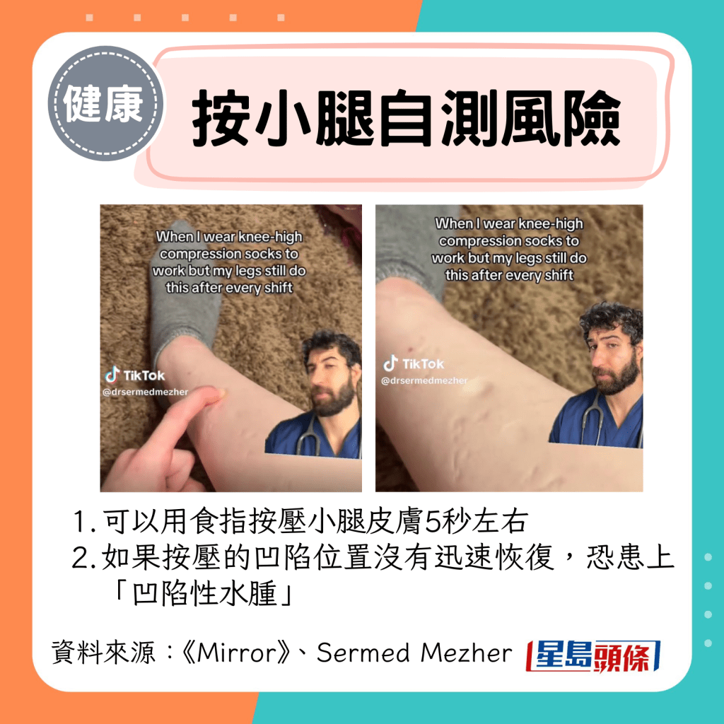 按小腿自测风险