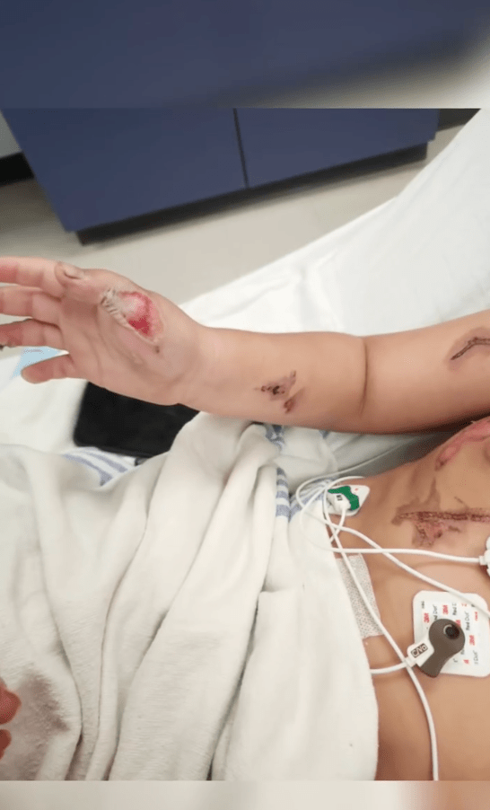 Lorenzo Lopez身上被電流灼傷的疤痕令人悚目驚心。