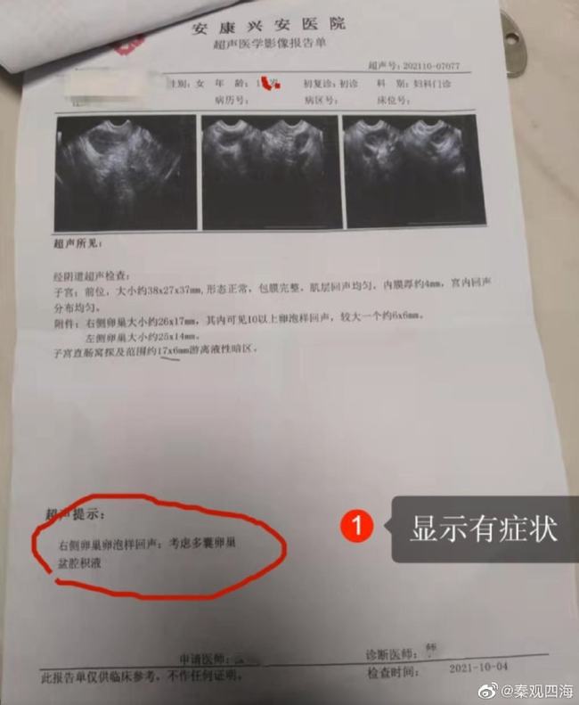 安康醫院的檢查指少女需要割瘜肉。 (網上圖片)