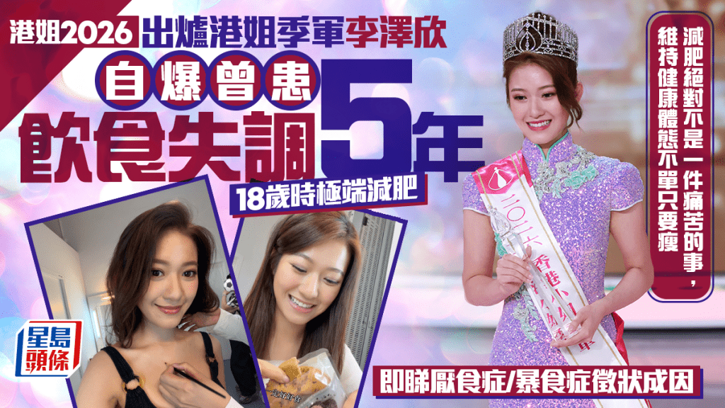 港姐2026｜出爐港姐季軍李澤欣自爆曾患飲食失調5年 18歲時極端減肥 附厭食症/暴食症徵狀成因