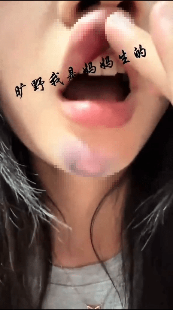 女遊客拍下玩「笨豬跳」被推下後的傷情。