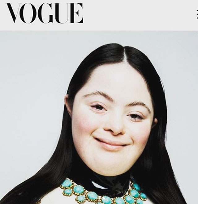 艾麗成《Vogue》首位唐氏綜合症模特兒。  Ellie Goldstein IG圖