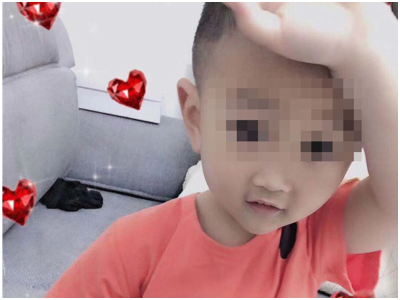 被虐待2歲男童,極大機會變植物人。網圖
