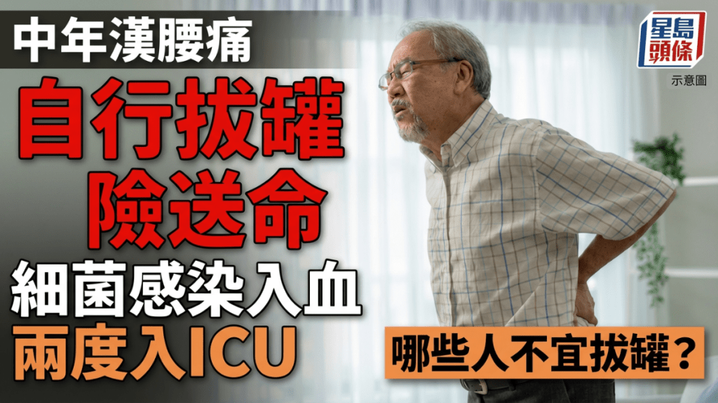 中年漢腰痛自行拔罐止痛險送命 細菌感染入血2度入ICU 哪些人不宜拔罐？