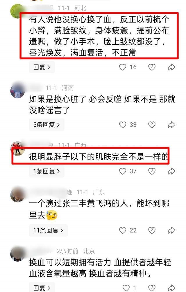 有網民指李連杰並非換心，而是換血。