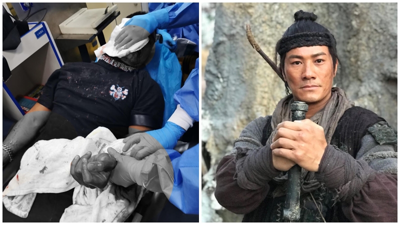 黃竣鋒還原被襲事件餘悸猶存 遇襲並非「點錯相」 細節令人震驚:眼球險被斬爆