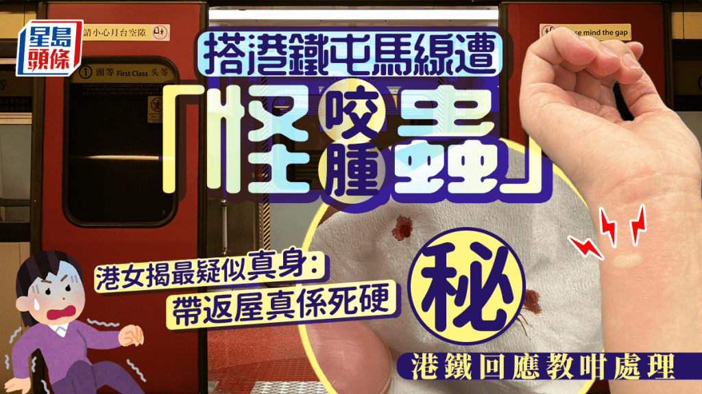 搭港鐵屯馬線遭「怪蟲」咬腫 港女揭最疑似真身:帶返屋真係死硬 港鐵回應教咁處理 搭港鐵屯馬線遭「怪蟲」咬腫 港女揭最疑似真身:帶返屋真係死硬 港鐵回應教咁處理
