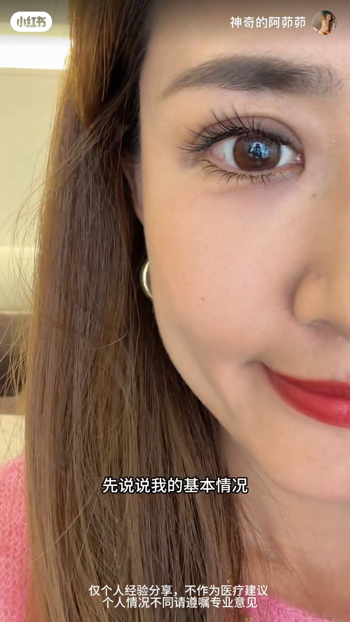 張茆表示上眼皮下垂，失去昔日神采。
