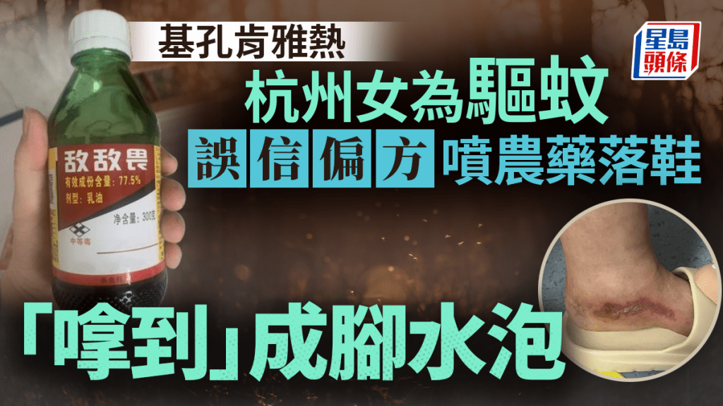 百毒之王︱杭州婦為驅蚊竟噴一物落鞋  「嗱到」滿腳水泡