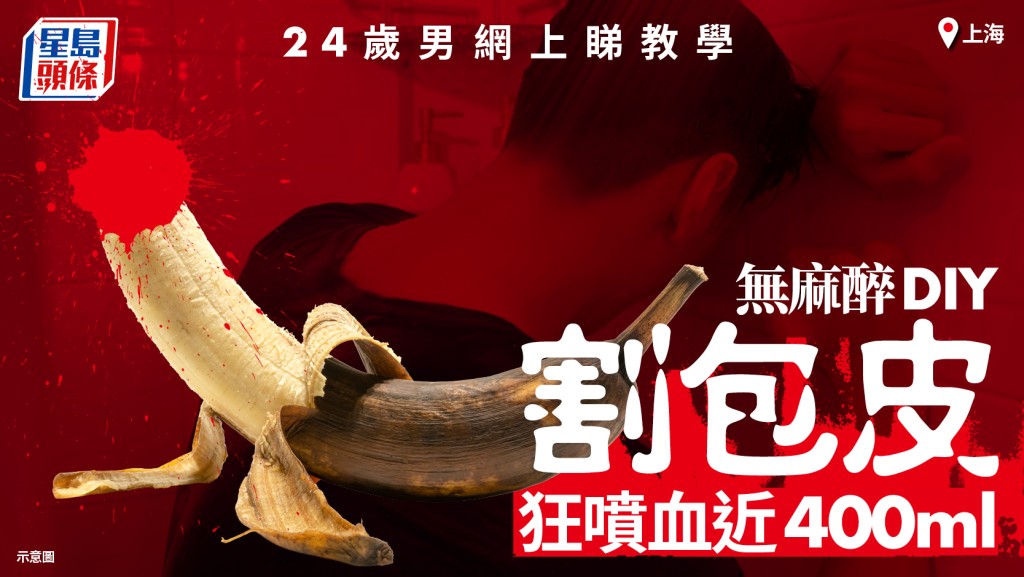 無麻醉割包皮︱24歲滬男網上睇教學DIY 醫生搶救：隨時終身不舉