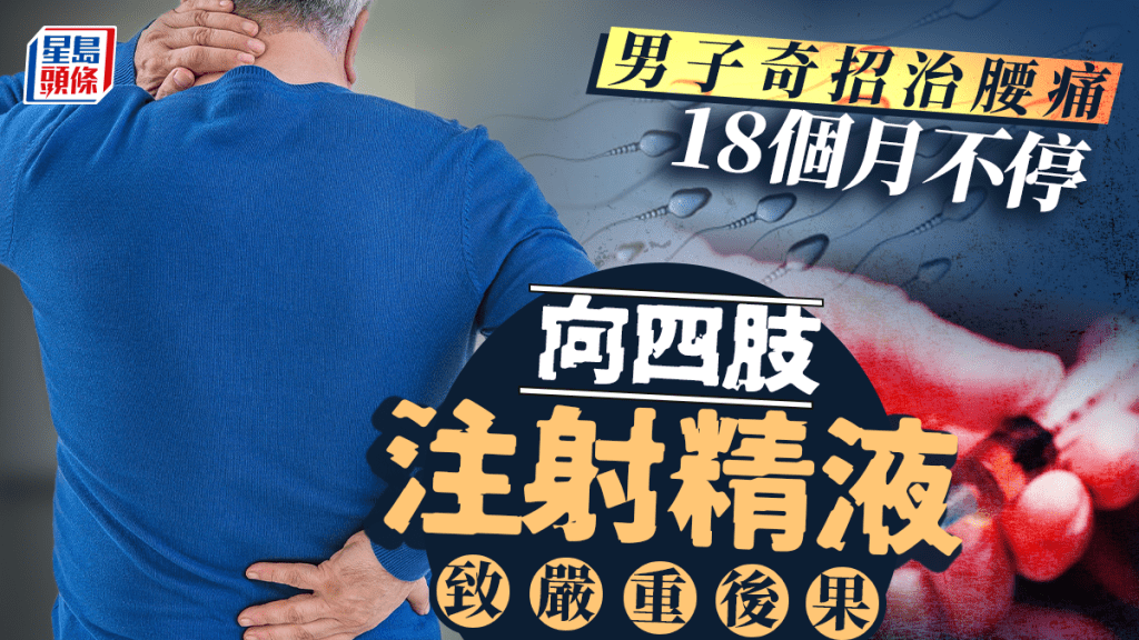 奇男自創「精子療法」治腰痛