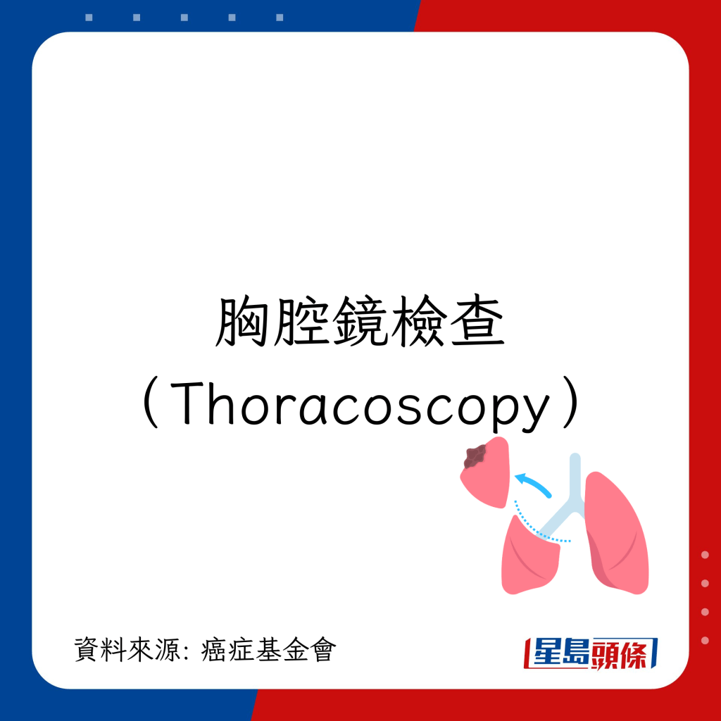 肺癌检查｜跟进检查7大方法：胸腔镜检查（Thoracoscopy）