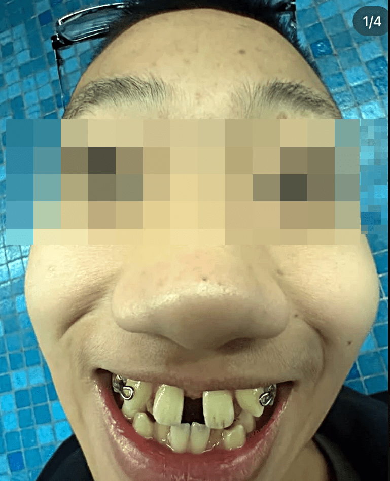 曾嘉楠年僅13歲，又稱「白卡特工」。網圖