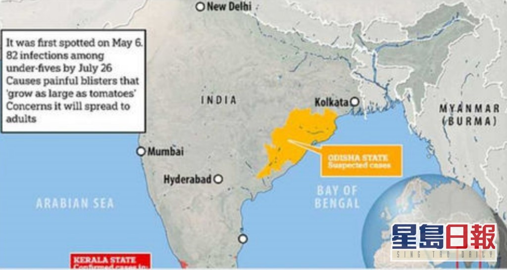 印度5月至7月間已回報有82個病例出現。網圖