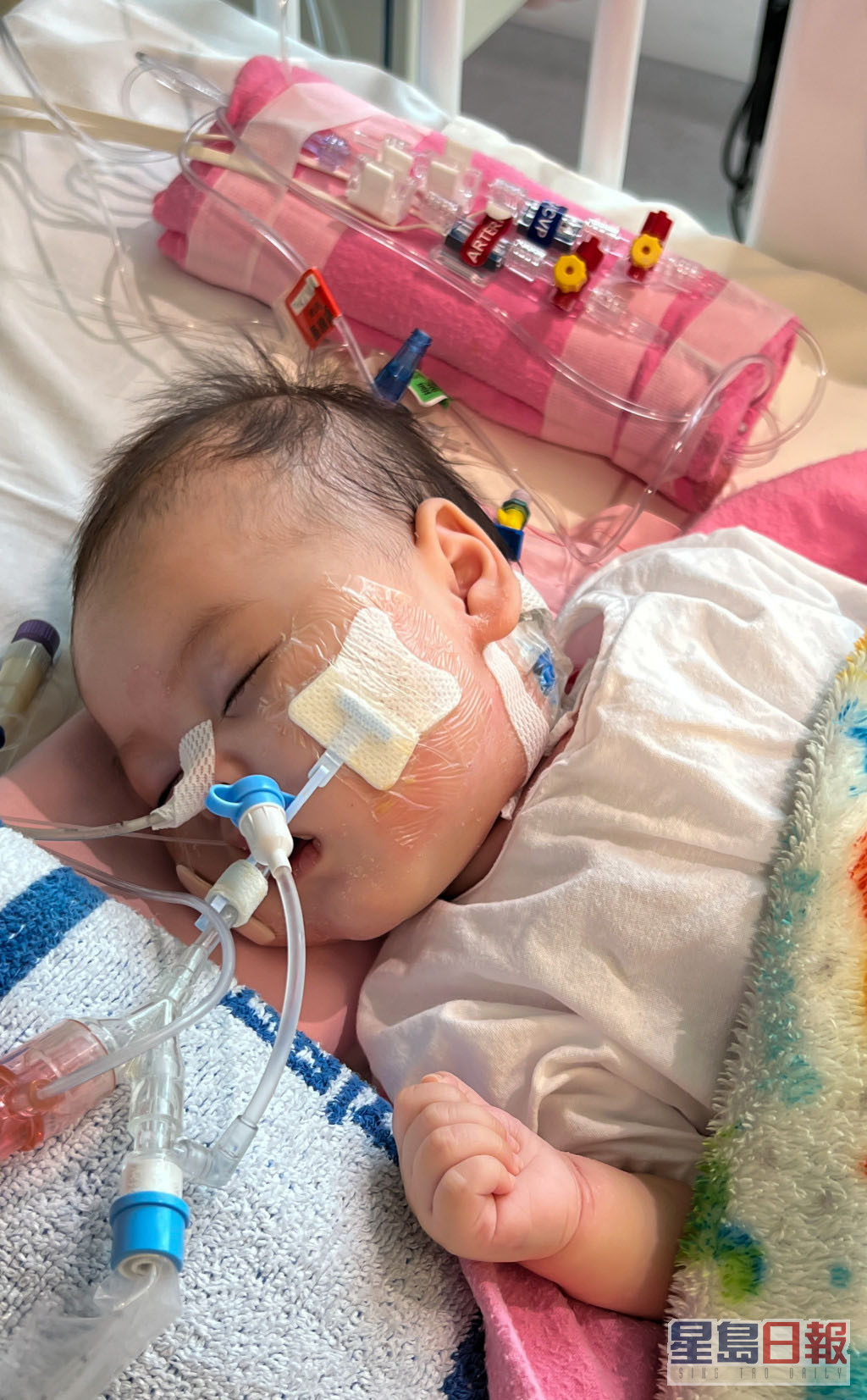 4个月大女婴芷希是1999年以来，仅有3宗成功的跨境器官捐赠个案之一。资料图片
