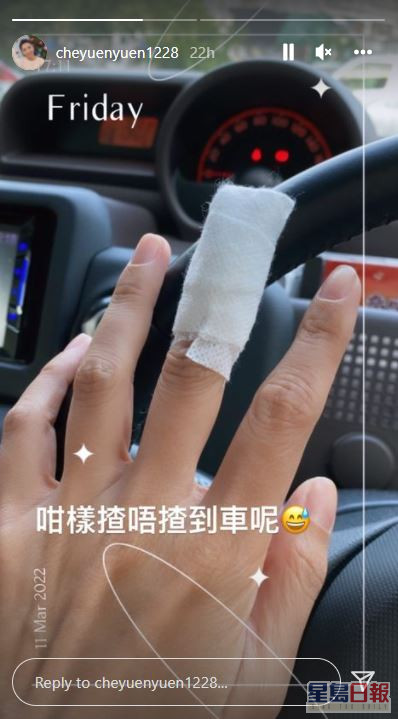 車婉婉手指受傷。