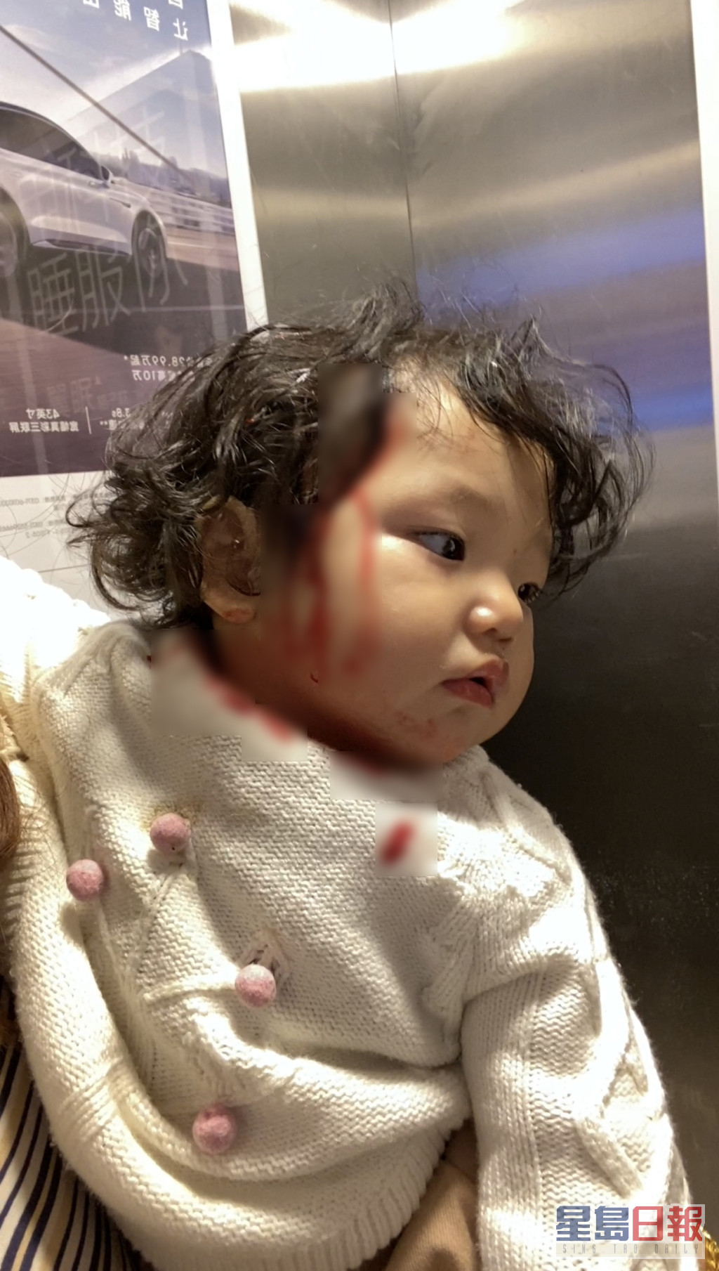 张兆艺上载女儿血流披面的照片。