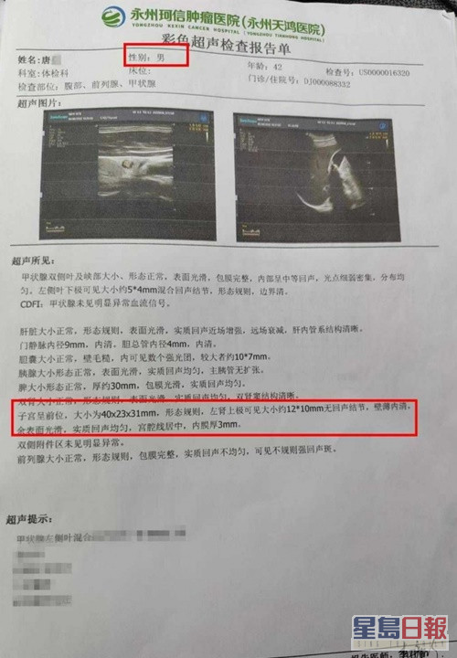 出错的体检报告清楚列出唐男「有子宫」及其检查结果。网上图片