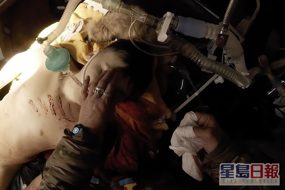 女军医拍下的片段纪录了受伤的乌克兰小男孩回天乏术。AP