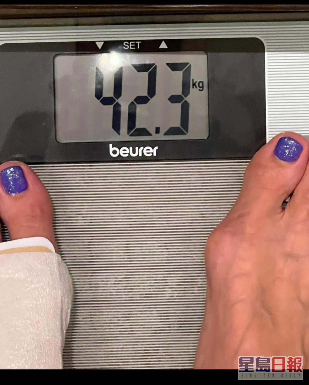 李玟去年12月31日除夕，貼出一張暴瘦至42.3公斤的照片，身上掛有「引流袋」。