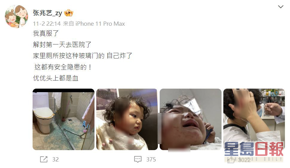 張兆藝日前於微博上載女兒優優血流披面，以及家中浴室玻璃門碎裂的照片。