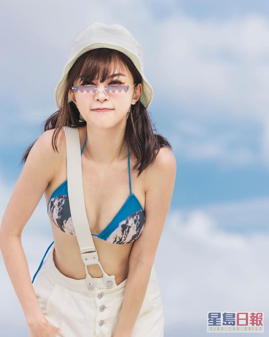 拥有32D骄人上围的赵咏瑶于2016年参加ViuTV选美节目《美选D.n.A》时，自爆曾以自体脂肪隆胸，而眼和鼻也「加工」过。