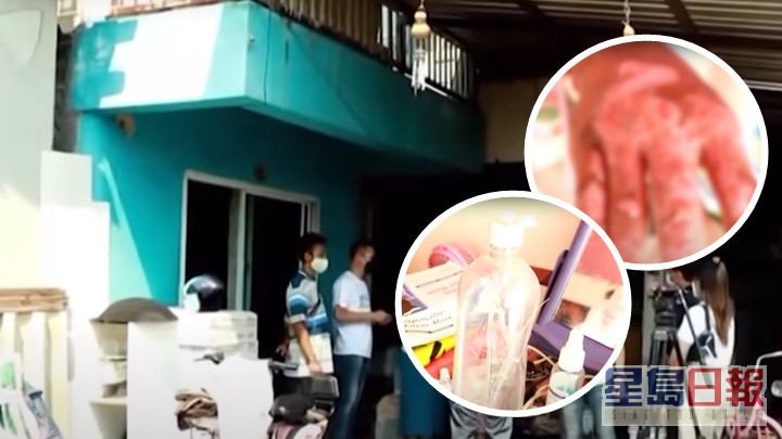 泰國一名女子以酒精噴灑全身消毒後點蚊香導致燒傷，當地政府人員到事發地點調查。網上片段截圖