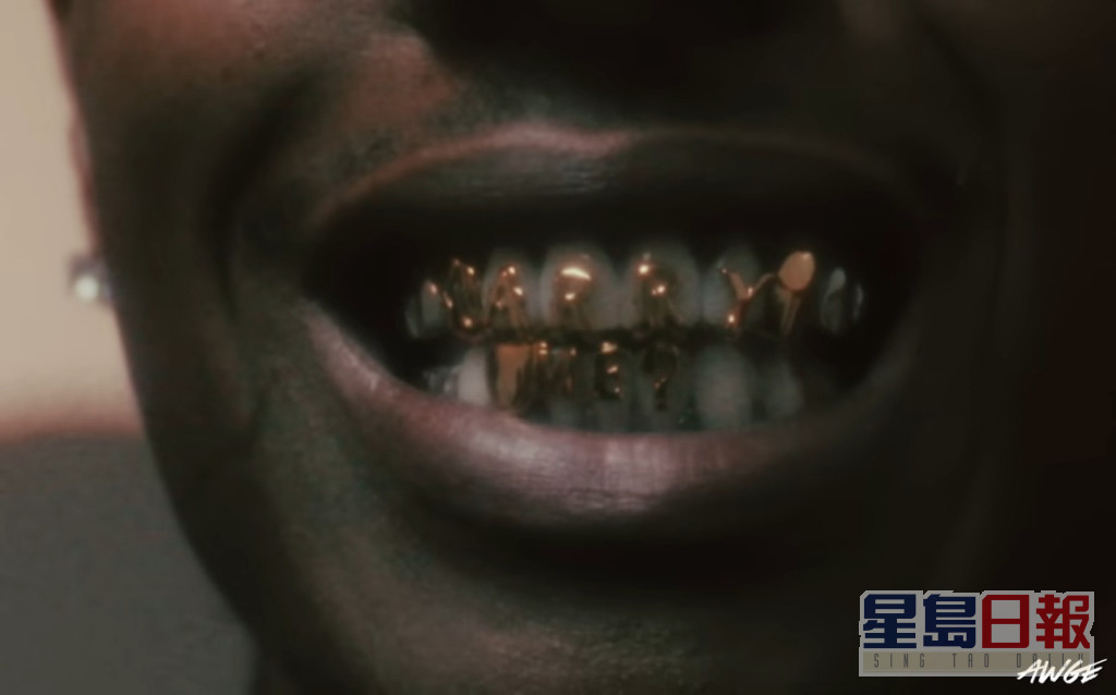 A$AP在牙套镶上「Marry Me?」字眼。