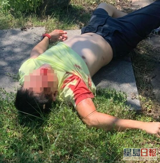 林志颖昨早在台湾发生严重车祸。