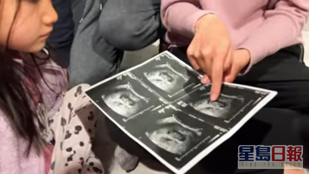 锺嘉欣拎住胎儿嘅超声波相片，向仔女讲解。