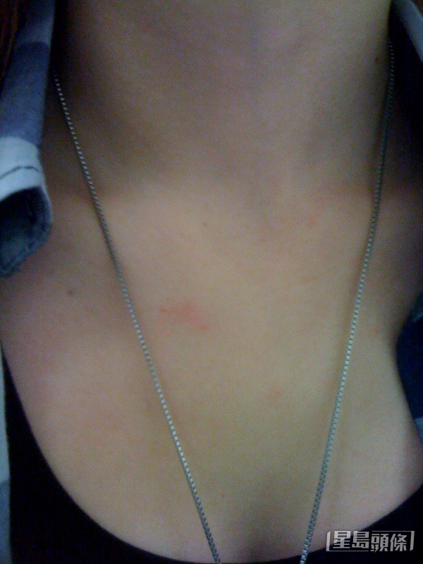 当时两人拍拖3个月,女方怒告被男方打,但开庭前放生前度,最后崔建邦判守行为一年,不留案底。