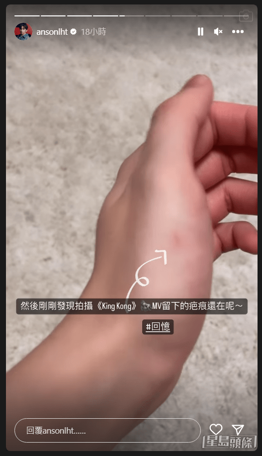 拍MV的傷痕還在。