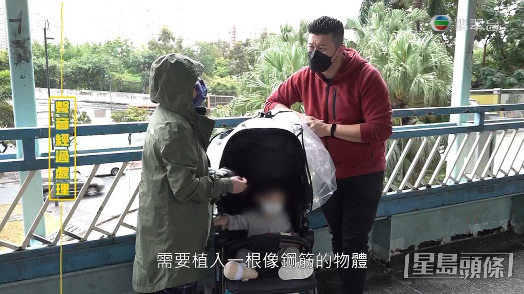 至於骨折方面，醫生表示現在軟骨開始重新生長，需要再作觀察，如果發現變歪，或有需要植入一根類似鋼根的物體以固定位置。