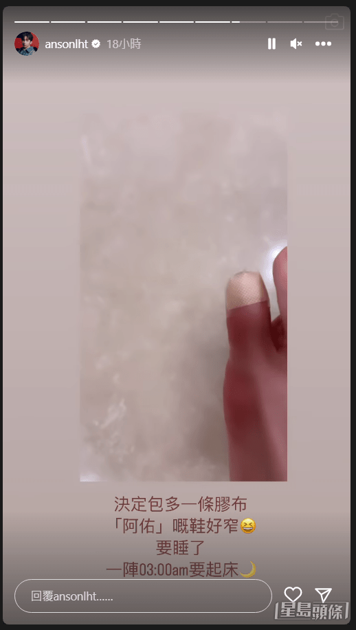 Anson Lo今日凌晨不斷在IG貼出手腳受傷的照片。