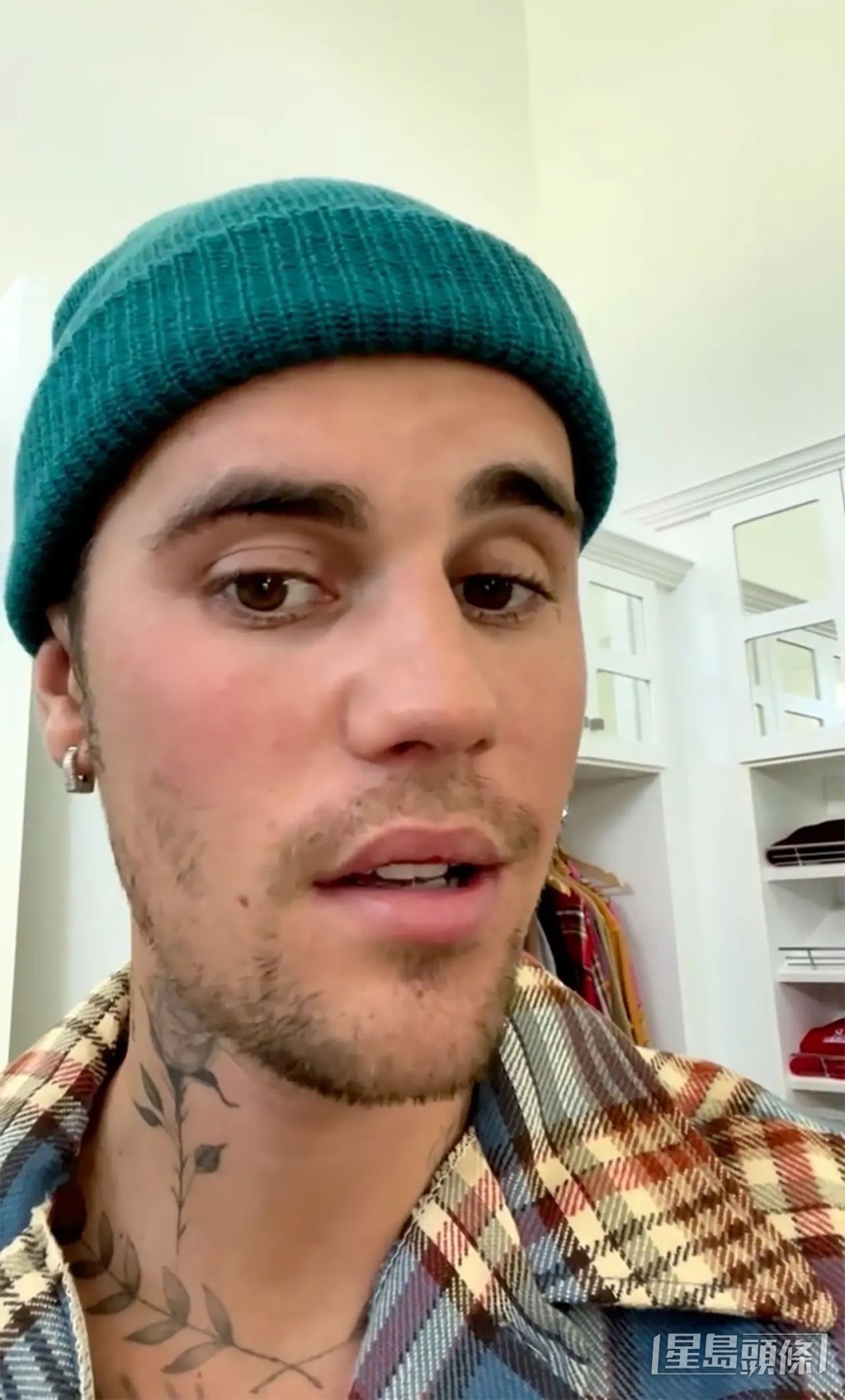 Justin拍片交代病情。