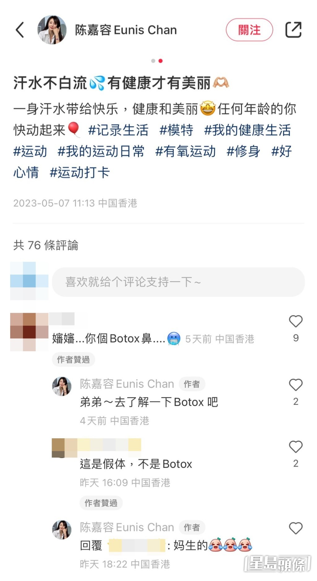 陳嘉容親自逐一回應網民，自言挺直高鼻是遺傳自父母的。