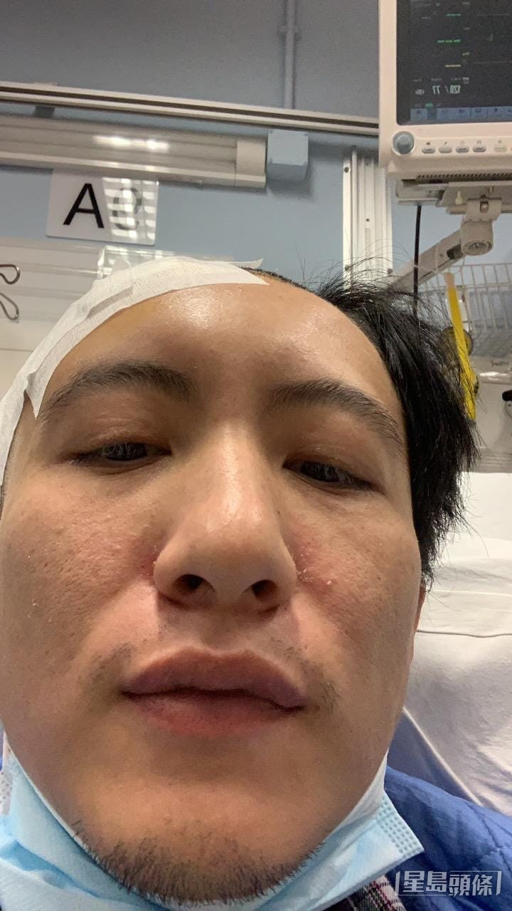 周永恆當時要留醫。