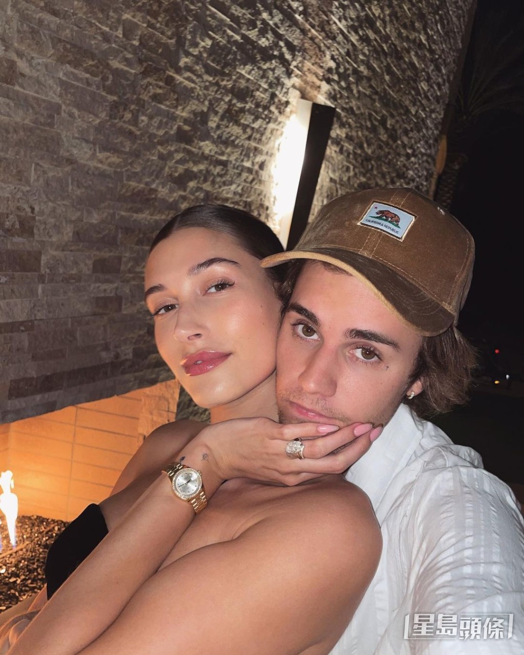 Justin的名模妻子Hailey曾出现过类似中风的症状。  ​