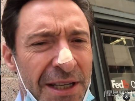 經歷了多次復發！