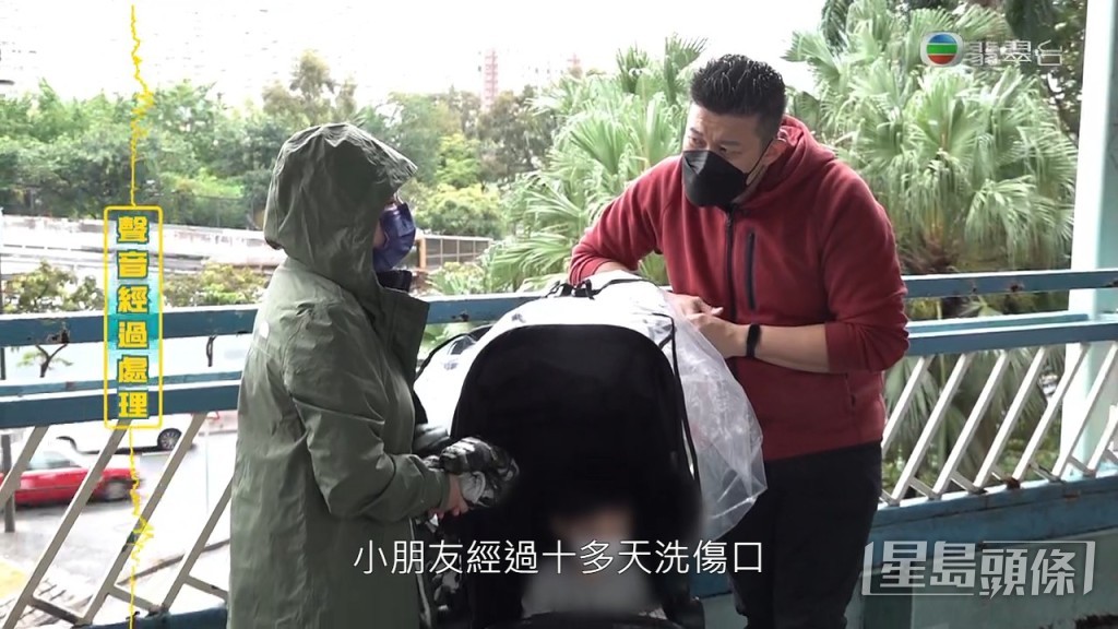 小朋友經過十多天洗傷口的過程，現在已經結焦。