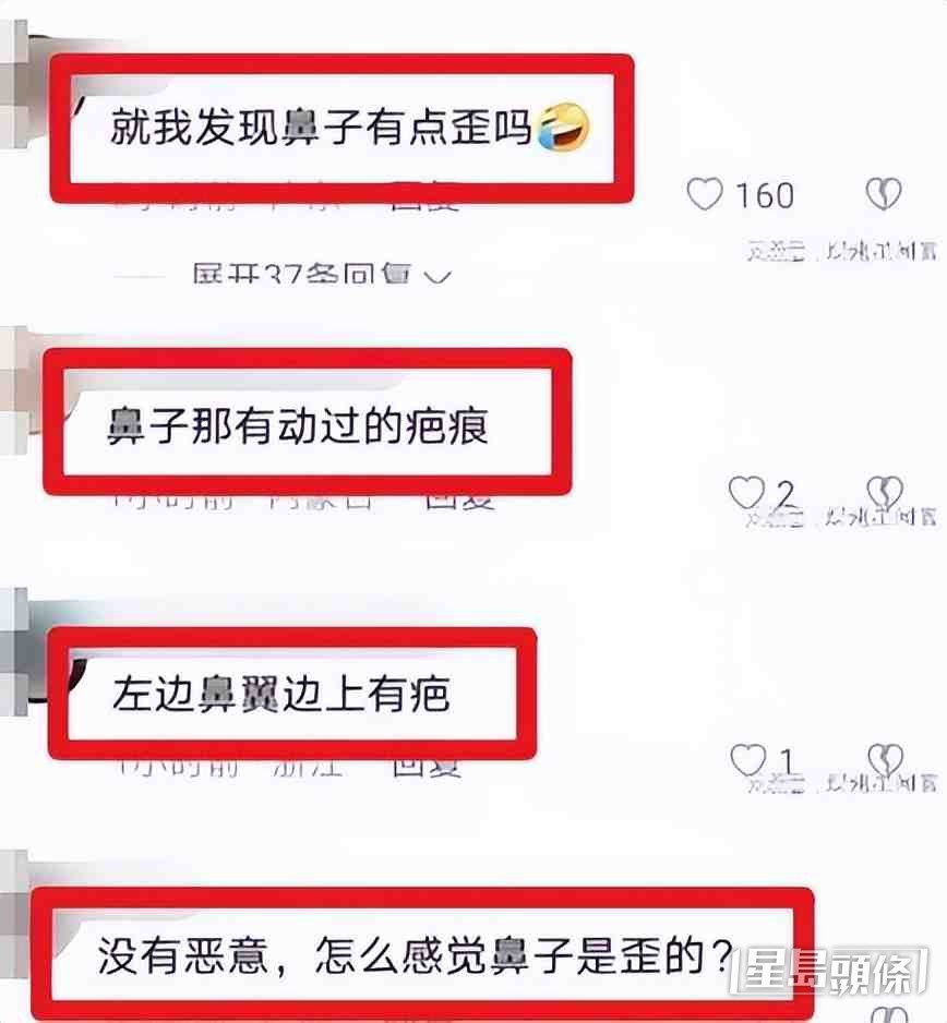 有內地網民觀看影片後，指看到方媛的鼻翼疑似有動刀的痕跡，更認為她的鼻骨顯歪，令方媛陷整容疑雲。