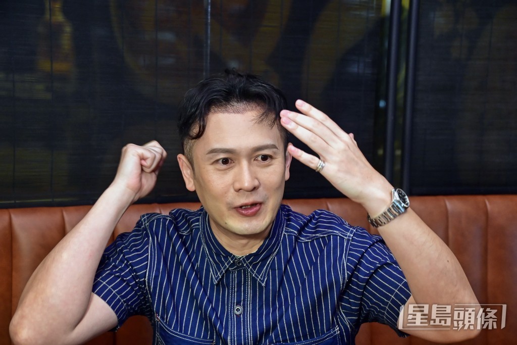 被脫髮問題困擾多年的Aaron，現在提起仍相當肉緊。