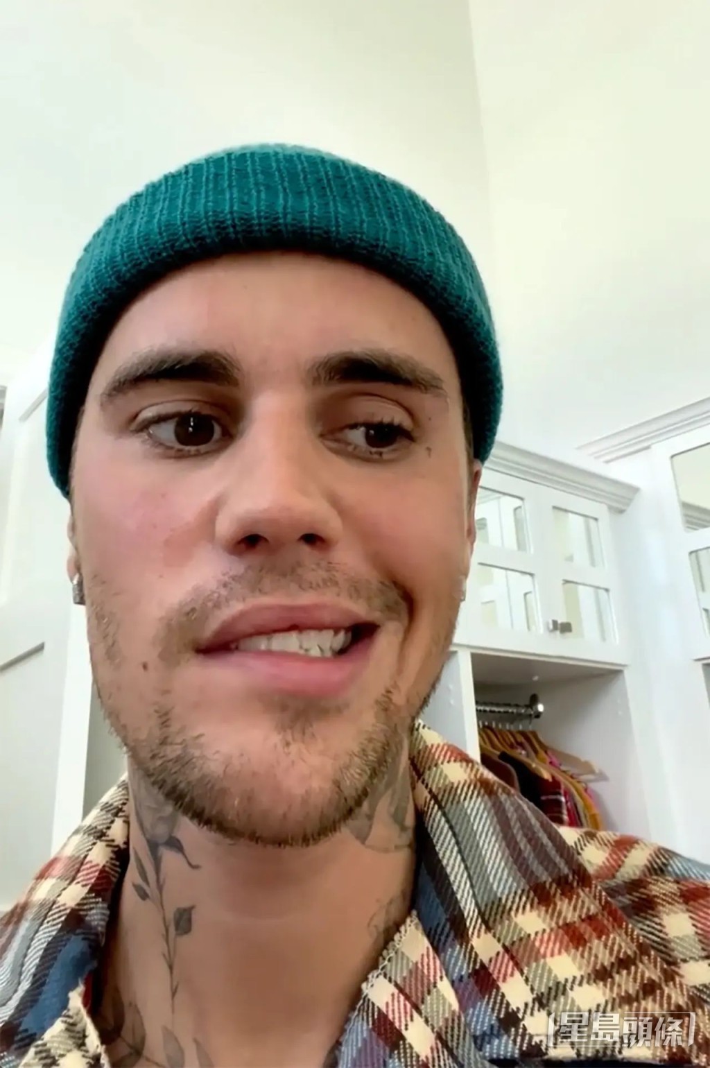 Justin讲讲下控制不到脸部神经。