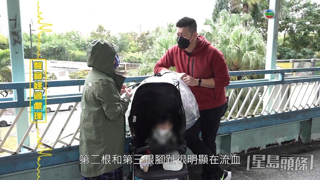第二、三根腳趾亦同時在流血。