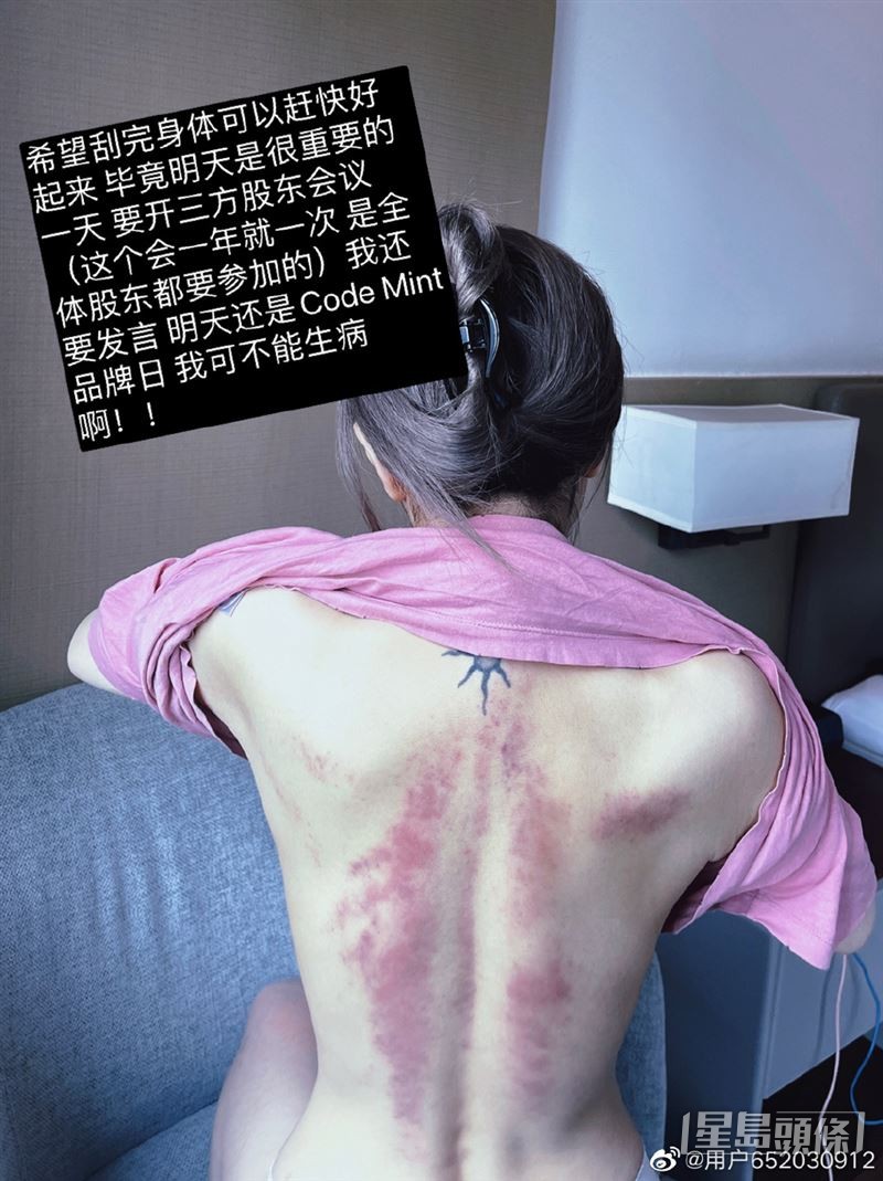 周揚青成身通紅，仲見到紋身。