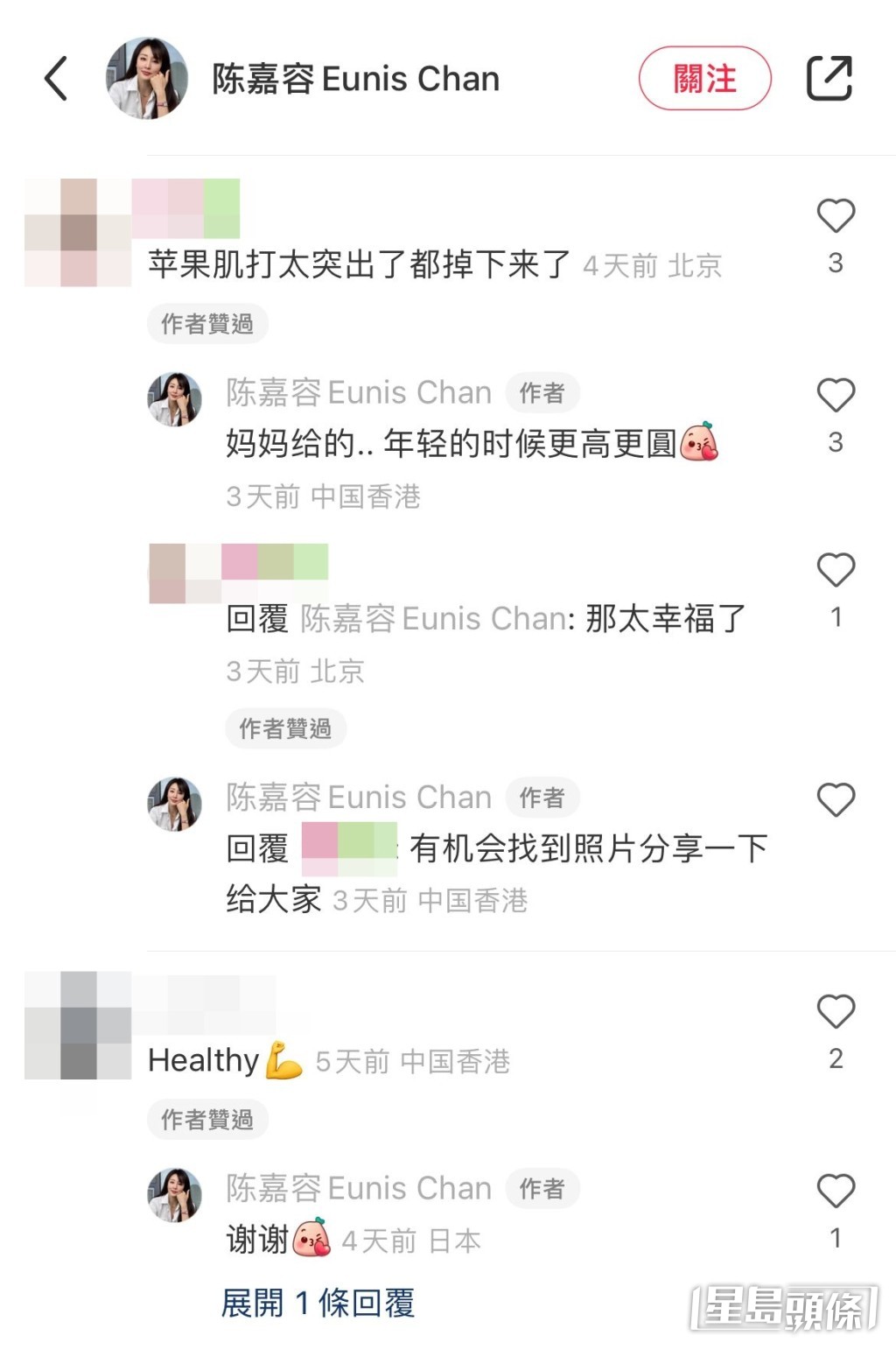陳嘉容又指，年輕時的蘋果肌更高更圓。