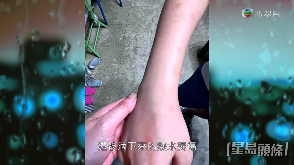 樓上漏落嚟啲水係熱水嚟！